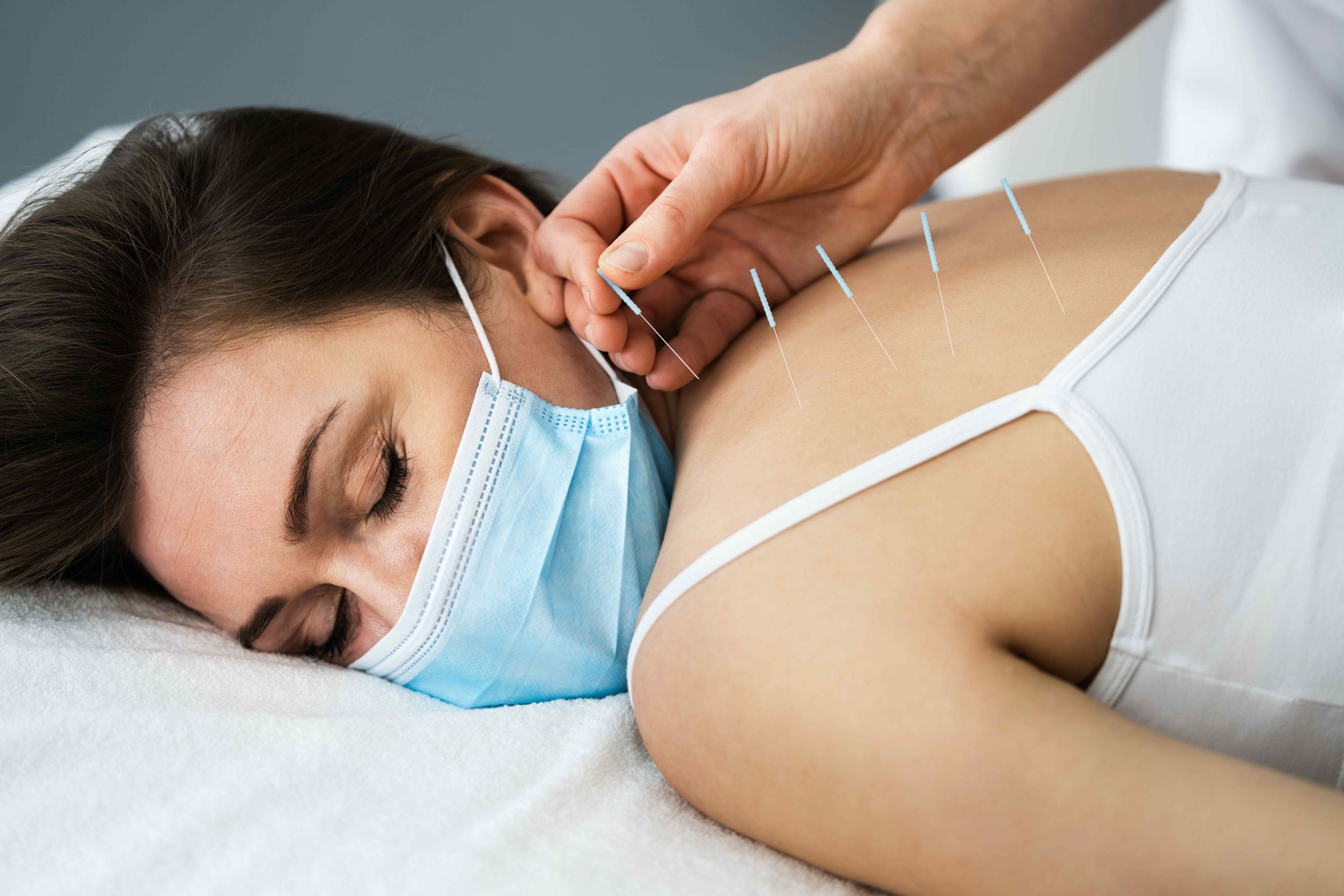 Dry Needling